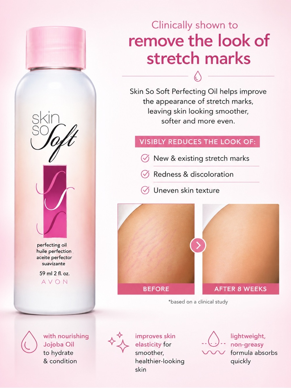 AVON SSS PERFECTING OIL - HEALS STRETCH MARKS (NEW WITH TAGS)